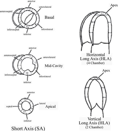 anteroseptal hypokinesis definition.